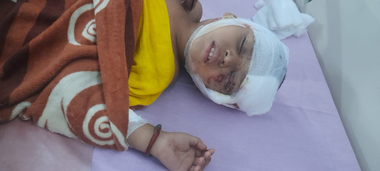 बिलासपुर के देवरीकुंड सफेद खदान में पागल कुत्ते ने किया हमला कई छोटे बच्चे और बुजुर्ग हुए जख्मी